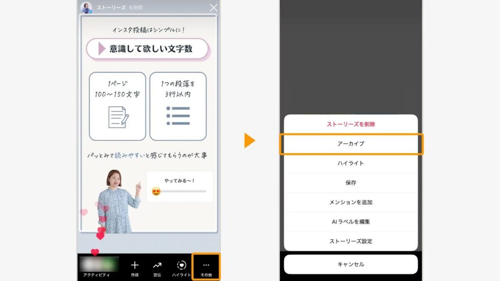 ストリーズの詳細から、アーカイブをタップ